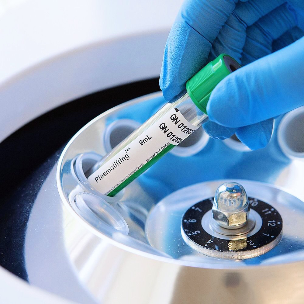  Как правильно выбрать лабораторную центрифугу? 