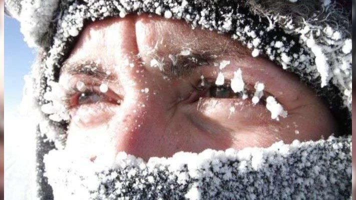Як розпізнати переохолодження та що робити: розʼяснення МОЗ