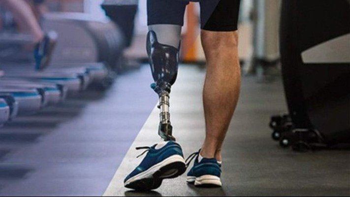  Росіяни поширюють фейк про те, що у Тернополі ломбард почав приймати протези в захисників 