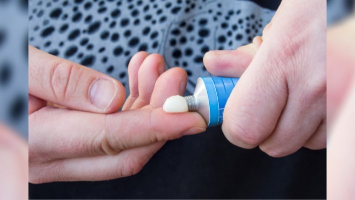 Кортикостероїди в дерматології: дія та показання