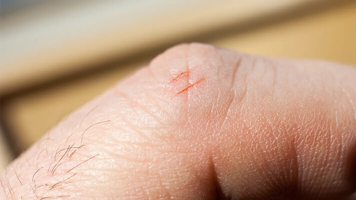 Чому порізи від паперу настільки болючі: пояснення феномену