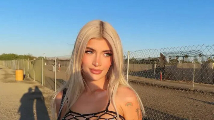 Модель OnlyFans розповіла про пережиті косметичні процедури